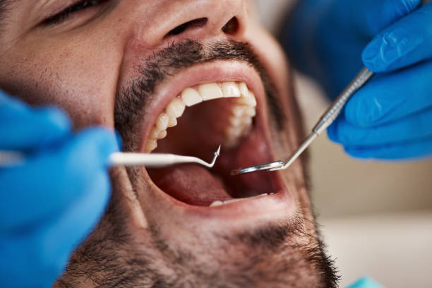 Best Dentist for Tooth Abscess  in Pleasant Garden, NC